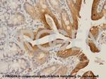 Adipophilin Antibody in Immunohistochemistry (IHC)