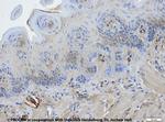 Cytokeratin Pan Type I/II Antibody in Immunohistochemistry (IHC)