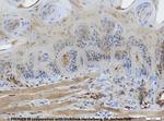 Cytokeratin Pan Type I/II Antibody in Immunohistochemistry (IHC)