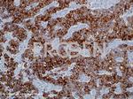 Cytokeratin 20 Antibody in Immunohistochemistry (IHC)