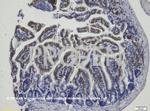 Cytokeratin 20 Antibody in Immunohistochemistry (IHC)