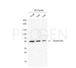 Cytokeratin 20 Antibody in Western Blot (WB)