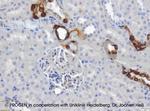 Cytokeratin 18 Antibody in Immunohistochemistry (IHC)