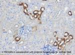 Cytokeratin 18 Antibody in Immunohistochemistry (IHC)