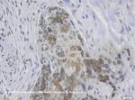 Cytokeratin 19 Antibody in Immunohistochemistry (IHC)