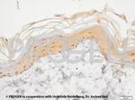 Cytokeratin 17 Antibody in Immunohistochemistry (IHC)