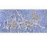 Cyclin D3 Antibody in Immunohistochemistry (Paraffin) (IHC (P))