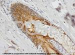 Cytokeratin 6 Antibody in Immunohistochemistry (IHC)