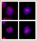 WRN Antibody in Immunocytochemistry (ICC/IF)