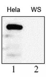 WRN Antibody in Western Blot (WB)