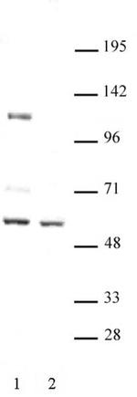 FOXG1 Antibody in Western Blot (WB)