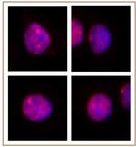 MLL / HRX Antibody in Immunocytochemistry (ICC/IF)