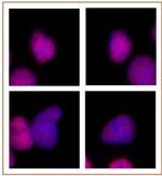 p300 Antibody in Immunocytochemistry (ICC/IF)