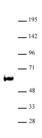 TDG / Thymine-DNA glycosylase Antibody in Western Blot (WB)