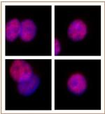 SMARCC2 / BAF170 Antibody in Immunocytochemistry (ICC/IF)