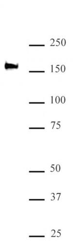 SMARCC2 / BAF170 Antibody in Western Blot (WB)