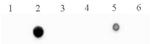 5-Methylcytosine (5-mC) Antibody in Dot Blot (DB)