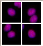 RBPJ Antibody in Immunocytochemistry (ICC/IF)