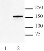 Cas9 Antibody in Western Blot (WB)