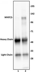 NFATC2 Antibody in Immunoprecipitation (IP)