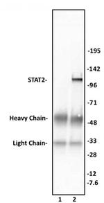 STAT2 Antibody in Immunoprecipitation (IP)