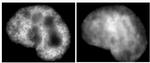 Histone H3K9ac Antibody in Immunocytochemistry (ICC/IF)