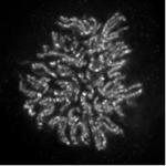 NCAPH2 Antibody in Immunocytochemistry (ICC/IF)