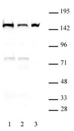 DHX9 Antibody in Western Blot (WB)