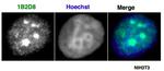 AATF / Che-1 Antibody in Immunocytochemistry (ICC/IF)