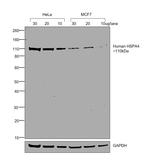 Human IgG (Gamma chain) Cross-Adsorbed Secondary Antibody in Western Blot (WB)