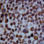 SSEA4 Antibody in Immunocytochemistry (ICC/IF)