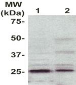 Phospho-RhoGDI (Tyr156) Antibody in Western Blot (WB)