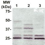 RhoGDI Antibody in Western Blot (WB)