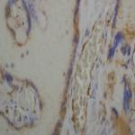 Phospho-TGFBR1 (Ser187, Ser189, Ser191) Antibody in Immunohistochemistry (Paraffin) (IHC (P))