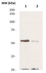 Phospho-TGFBR1 (Ser187, Ser189, Ser191) Antibody in Western Blot (WB)