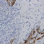 ARK1C2 Antibody in Immunohistochemistry (Paraffin) (IHC (P))