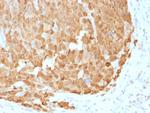 S100A1 Antibody in Immunohistochemistry (Paraffin) (IHC (P))