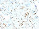 S100A2/S100 Calcium Binding Protein A2 Antibody in Immunohistochemistry (Paraffin) (IHC (P))