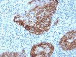 S100A2/S100 Calcium Binding Protein A2 Antibody in Immunohistochemistry (Paraffin) (IHC (P))