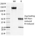 S100A4/Metastasin/Calvasculin Antibody in SDS-PAGE (SDS-PAGE)