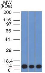 S100A4/Metastasin/Calvasculin Antibody in Western Blot (WB)