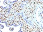 S100A4/Metastasin/Calvasculin Antibody in Immunohistochemistry (Paraffin) (IHC (P))