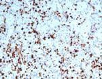 S100A4/Metastasin/Calvasculin (Marker of Tumor Metastasis) Antibody in Immunohistochemistry (Paraffin) (IHC (P))