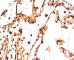 S100A4/Metastasin/Calvasculin (Marker of Tumor Metastasis) Antibody in Immunohistochemistry (Paraffin) (IHC (P))