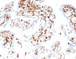S100A4/Metastasin/Calvasculin (Marker of Tumor Metastasis) Antibody in Immunohistochemistry (Paraffin) (IHC (P))