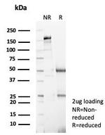 S100A4/Metastasin/Calvasculin (Marker of Tumor Metastasis) Antibody in SDS-PAGE (SDS-PAGE)