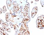 S100A4/Metastasin/Calvasculin (Marker of Tumor Metastasis) Antibody in Immunohistochemistry (Paraffin) (IHC (P))