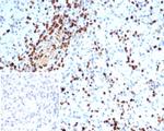 S100A4/Metastasin/Calvasculin (Marker of Tumor Metastasis) Antibody in Immunohistochemistry (Paraffin) (IHC (P))