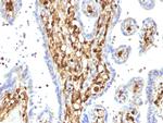 S100A4/Metastasin/Calvasculin (Marker of Tumor Metastasis) Antibody in Immunohistochemistry (Paraffin) (IHC (P))