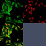 S100A4/Metastasin/Calvasculin (Marker of Tumor Metastasis) Antibody in Immunocytochemistry (ICC/IF)